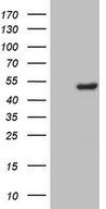 HEK293T cells were transfected with the pCMV6-ENTRY control (Left lane) or pCMV6-ENTRY CSNK1G1 (Right lane) cDNA for 48 hrs and lysed. Equivalent amounts of cell lysates (5 ug per lane) were separated by SDS-PAGE and immunoblotted with anti-CSNK1G1.