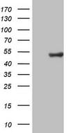 HEK293T cells were transfected with the pCMV6-ENTRY control (Left lane) or pCMV6-ENTRY CSNK1G1 (Right lane) cDNA for 48 hrs and lysed. Equivalent amounts of cell lysates (5 ug per lane) were separated by SDS-PAGE and immunoblotted with anti-CSNK1G1.