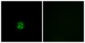 Immunofluorescence of A549 cells, using CHST6 Antibody. The picture on the right is treated with the synthesized peptide.