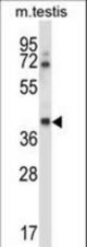 Mouse Csnk1g1 Antibody western blot of mouse testis tissue lysates (35 ug/lane). The Csnk1g1 antibody detected the Csnk1g1 protein (arrow).