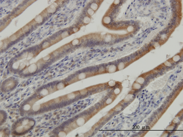 Immunoperoxidase of monoclonal antibody to CSNK1G1 on formalin-fixed paraffin-embedded human small Intestine. [antibody concentration 3 ug/ml]