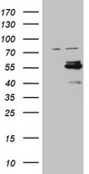 HEK293T cells were transfected with the pCMV6-ENTRY control (Left lane) or pCMV6-ENTRY CSNK1G1 (Right lane) cDNA for 48 hrs and lysed. Equivalent amounts of cell lysates (5 ug per lane) were separated by SDS-PAGE and immunoblotted with anti-CSNK1G1.