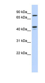 CHST6 antibody LS-C111202 Western blot of Jurkat lysate.