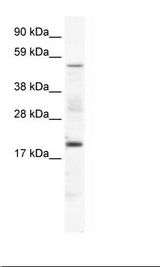 SP2/0 Cell Lysate