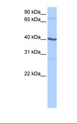HEPG2 cell lysate. Antibody concentration: 0.5 ug/ml. Gel concentration: 12%.