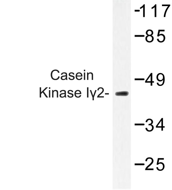 Western blot of Casein Kinase I2 (G7) pAb in extracts from HeLa cells.