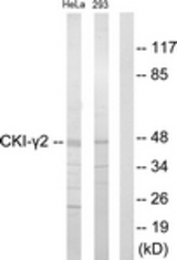 Western blot of extracts from HeLa/293 cells, using CKI-gamma2 Antibody. The lane on the right is treated with the synthesized peptide.