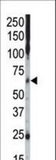 Western blot of anti-CK1g2 C-term antibody in mouse muscle tissue lysate. CK1g2 (arrow) was detected using purified antibody. Secondary HRP-anti-rabbit was used for signal visualization with chemiluminescence.