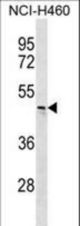 CHST6 Antibody western blot of NCI-H460 cell line lysates (35 ug/lane). The CHST6 antibody detected the CHST6 protein (arrow).
