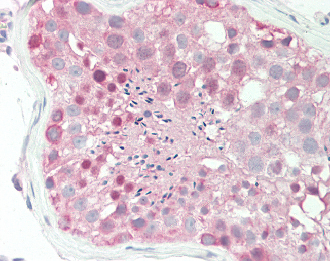 Human Testis: Formalin-Fixed, Paraffin-Embedded (FFPE)