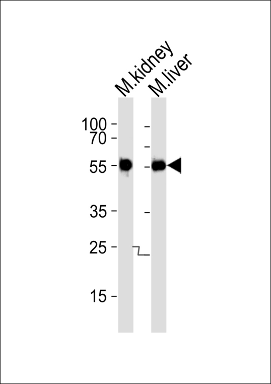 Western blot of lysates from mouse kidney and liver tissue lysate (from left to right), using Mouse Csnk1g3 Antibody. Antibody was diluted at 1:1000 at each lane. A goat anti-rabbit IgG H&L (HRP) at 1:5000 dilution was used as the secondary antibody. Lysates at 35ug per lane.