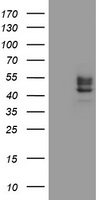 HEK293T cells were transfected with the pCMV6-ENTRY control (Left lane) or pCMV6-ENTRY CHST6 (Right lane) cDNA for 48 hrs and lysed. Equivalent amounts of cell lysates (5 ug per lane) were separated by SDS-PAGE and immunoblotted with anti-CHST6.