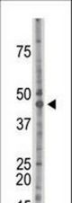 The anti-CSNK2A1 antibody is used in Western blot to detect CSNK2A1 in mouse brain tissue lysate.