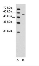 A: Marker, B: Jurkat Cell Lysate