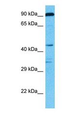 Western blot of CHSS1 Antibody with human 786-0 Whole Cell lysate.