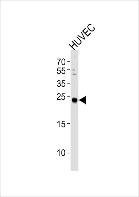 Western blot of lysate from HUVEC cell line, using CSNK2B Antibody. Antibody was diluted at 1:1000 at each lane. A goat anti-rabbit IgG H&L (HRP) at 1:5000 dilution was used as the secondary antibody. Lysate at 35ug per lane.