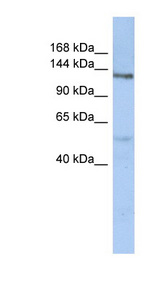 CHSY3 antibody LS-C111225 Western blot of OVCAR-3 cell lysate.