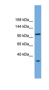 CHTF18 antibody LS-C116698 Western blot of Fetal liver lysate.