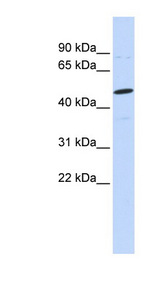 CSPG5 / Neuroglycan C antibody LS-C102245 Western blot of MCF7 cell lysate.
