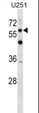 CSPG5 Antibody western blot of U251 cell line lysates (35 ug/lane). The CSPG5 antibody detected the CSPG5 protein (arrow).