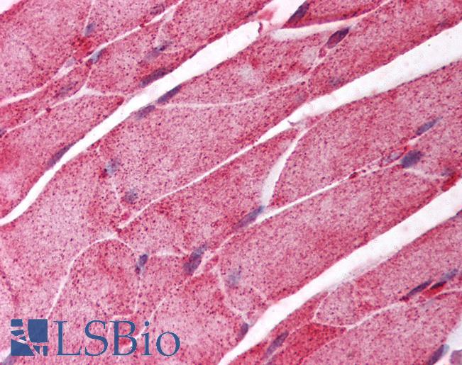 Anti-CSRNP1 / AXUD1 antibody IHC of human skeletal muscle. Immunohistochemistry of formalin-fixed, paraffin-embedded tissue after heat-induced antigen retrieval. Antibody LS-B236 concentration 5 ug/ml.