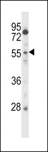 CSRNP2 Antibody western blot of CEM cell line lysates (35 ug/lane). The CSRNP2 antibody detected the CSRNP2 protein (arrow).