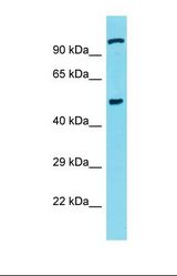 Western blot of Human Jurkat. CSRNP3 antibody dilution 1.0 ug/ml.