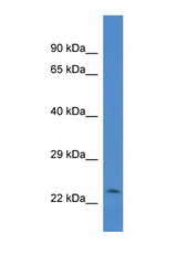CSRP2 antibody LS-C134987 Western blot of Mouse Pancreas lysate. Antibody concentration 1 ug/ml.
