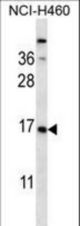CSRP2 Antibody western blot of NCI-H460 cell line lysates (35 ug/lane). The CSRP2 antibody detected the CSRP2 protein (arrow).