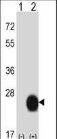 Western blot of CSRP2 (arrow) using rabbit polyclonal CSRP2 Antibody. 293 cell lysates (2 ug/lane) either nontransfected (Lane 1) or transiently transfected (Lane 2) with the CSRP2 gene.