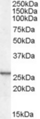 Antibody (0.1 ug/ml) staining of mouse kidney lysate (35 ug protein in RIPA buffer). Primary incubation was 1 hour. Detected by chemiluminescence.