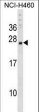 CSRP3 Antibody western blot of NCI-H460 cell line lysates (35 ug/lane). The CSRP3 antibody detected the CSRP3 protein (arrow).