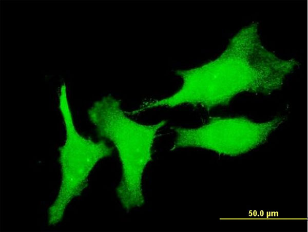 Immunofluorescence of monoclonal antibody to CSRP3 on HeLa cell . [antibody concentration 10 ug/ml]