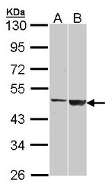 Sample (30 ug of whole cell lysate). A: H1299, B: Raji. 10% SDS PAGE. CST / GAL3ST1 antibody diluted at 1:1000.