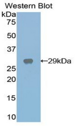 Western blot of recombinant CST / GAL3ST1.