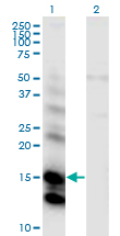 Western Blot analysis of CST6 expression in transfected 293T cell line by CST6 monoclonal antibody (M01), clone 2H8.Lane 1: CST6 transfected lysate (Predicted MW: 16.5 KDa).Lane 2: Non-transfected lysate.