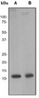 Western blot analysis on (A) human bladder and (B) U87-MG cell lysates using anti-Cystatin B antibody (LS-C105748).