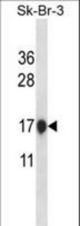 CSTB Antibody western blot of SK-BR-3 cell line lysates (35 ug/lane). The CSTB antibody detected the CSTB protein (arrow).