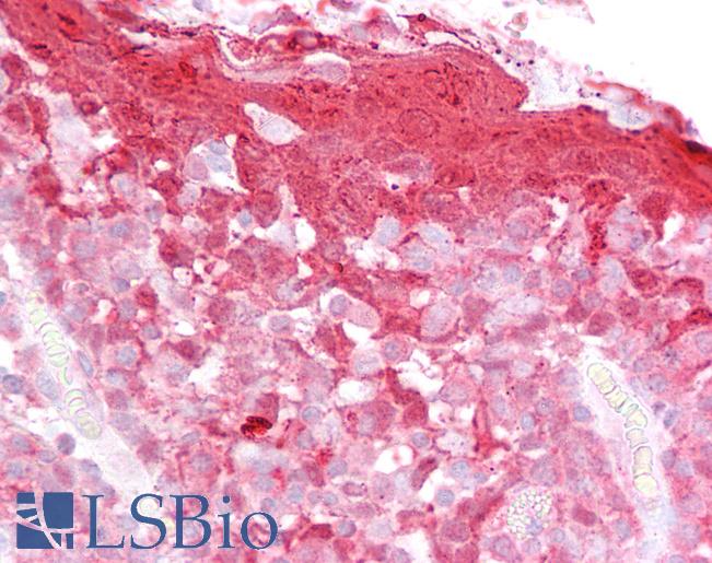 Anti-CSTB / Stefin B antibody IHC of human tonsil. Immunohistochemistry of formalin-fixed, paraffin-embedded tissue after heat-induced antigen retrieval. Antibody LS-B6463 concentration 2.5 ug/ml.