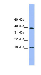 CSTB / Stefin B antibody LS-C116994 Western blot of Fetal Heart lysate.