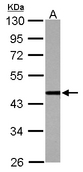 Sample (30 ug of whole cell lysate) A: Jurkat 10% SDS PAGE CSTF1 antibody diluted at 1:1000