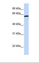 293T cell lysate. Antibody concentration: 1.0 ug/ml. Gel concentration: 12%.
