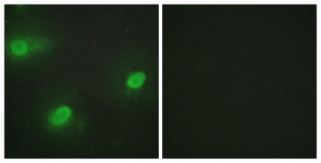 Immunofluorescence of HeLa cells, using CSTF2 Antibody. The picture on the right is treated with the synthesized peptide.