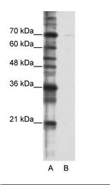 A: Marker, B: HepG2 Cell Lysate