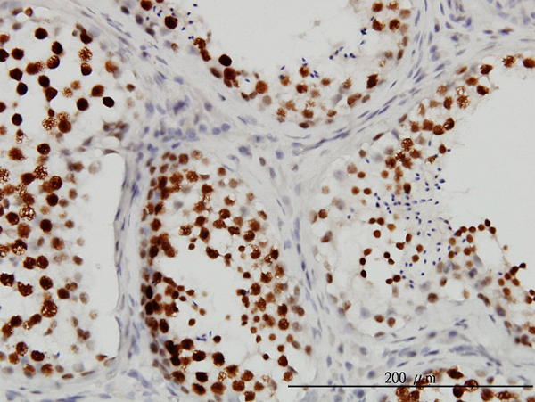 Immunoperoxidase of monoclonal antibody to CSTF3 on formalin-fixed paraffin-embedded human testis. [antibody concentration 3 ug/ml].