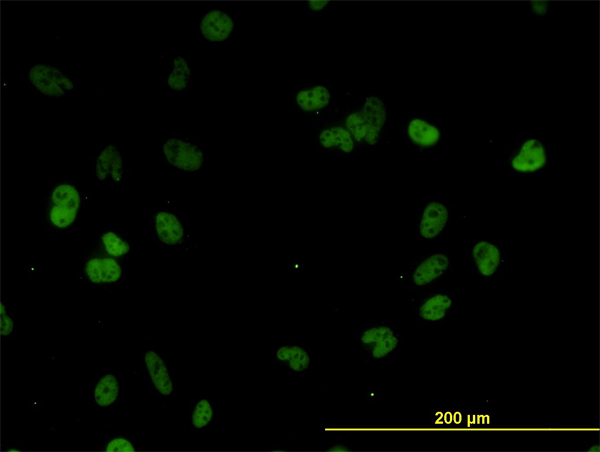 Immunofluorescence of monoclonal antibody to CSTF3 on HeLa cell. [antibody concentration 10 ug/ml]