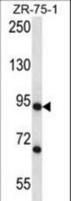 CSTF3 Antibody western blot of ZR-75-1 cell line lysates (35 ug/lane). The CSTF3 antibody detected the CSTF3 protein (arrow).