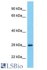 CT47A11 antibody Western Blot of HeLa. Antibody dilution: 1 ug/ml.
