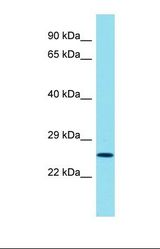 Western blot of Human HT1080. CXorf48 antibody dilution 1.0 ug/ml.