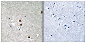 IHC of paraffin-embedded human brain, using CtBP1 (Phospho-Ser422) Antibody. The sample on the right was incubated with synthetic peptide.